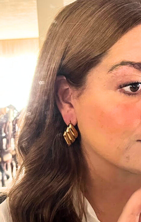 ARETES TRIANGULO